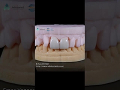 Естественный прессованный EMAX фанера прочность 16 оттенков Emax зубные фанеры