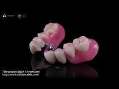 Внутренний телескоп и внешний телескоп с металлическими частицами