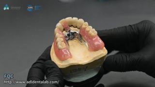 Качество точной пайки телескопической короны