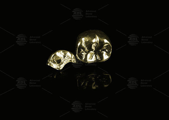 Купить Драгоценный сплав Желтое золото 60% Полнометаллическая корона Золото Окончание Полнометаллическая корона Производство в сети