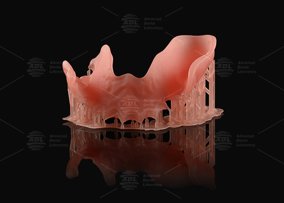Купить Оранжевый розовый акриловый частичный протез натурального вида 3D печать цифровые протезы Производство в сети