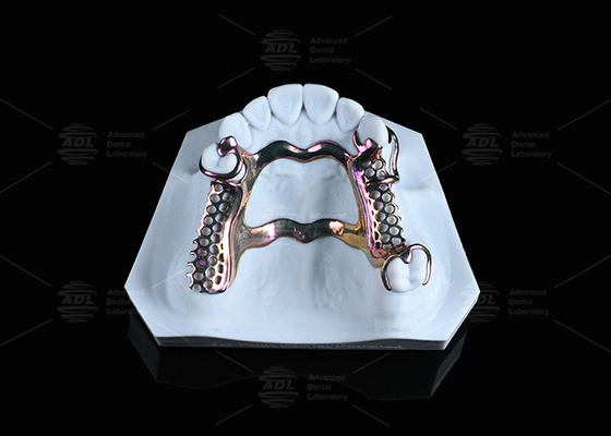 Купить Чувствительная кожа Высокопрочная титановая рама 3D-печать Производство в сети