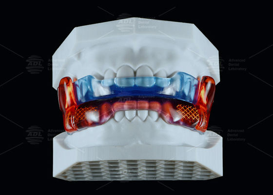Купить Силиконовый антихрап медицинского класса для улучшения сна Производство в сети