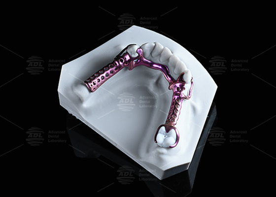 Купить Анодированный 3D титановый каркас высокая прочность и легкий вес и регулируемый Производство в сети