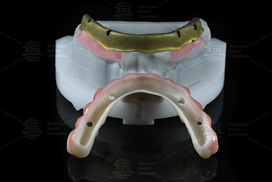 Купить Китайская стоматологическая лаборатория совместима с большинством систем зубных имплантатов все на 4 предлагает в течение 72 часов время обработки и массив технических параметров Производство в сети