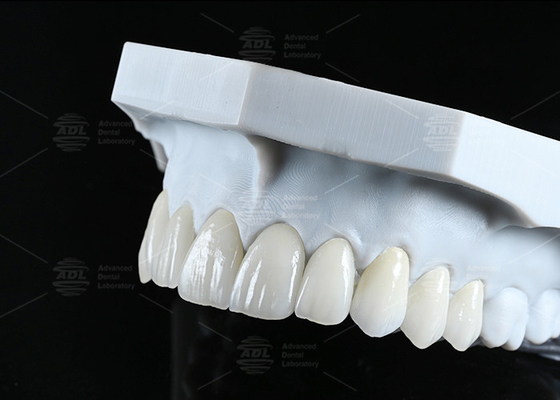 Транслюцентность CAD EMAX Фанера Полированные остекленные керамические реставрации для передних задних областей