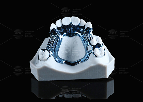 Титановая рамка с анодированной 3D-печатью, легкая и подходящая для чувствительной кожи