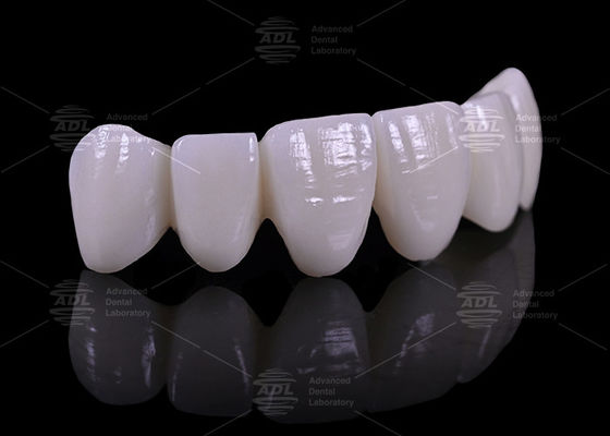 Конкурентоспособные цены со скидкой на объем Стоматологическая лаборатория предлагает 16 оттенков стоматологических протезов, предназначенных для медицинской промышленности