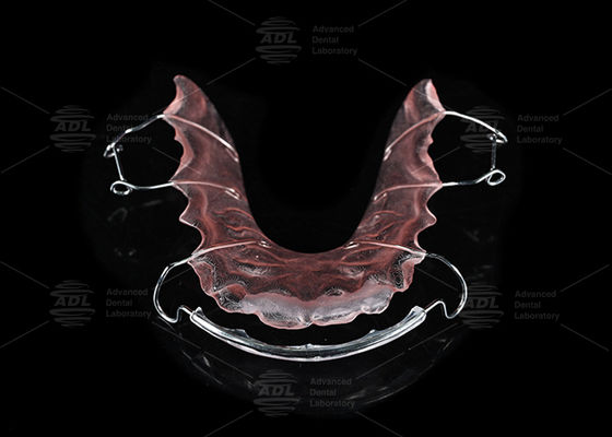 Китайская стоматологическая лаборатория Нержавеющая сталь и акриловый ортодонтический ретейнер Hawley для ортодонтического лечения