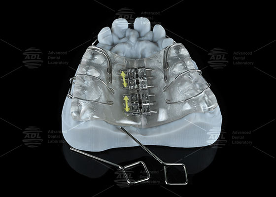 China Dental Lab Colorful Stainless Steel Screw Expander for Maxilla and Mandible Expansion