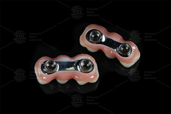 Укрепление Implant Bar CAD CAM Разработан для точности Подходит совместимо с большинством систем зубных имплантатов, обеспечивающих решение проблемы восстановления зубов Китайская стоматологическая лаборатория